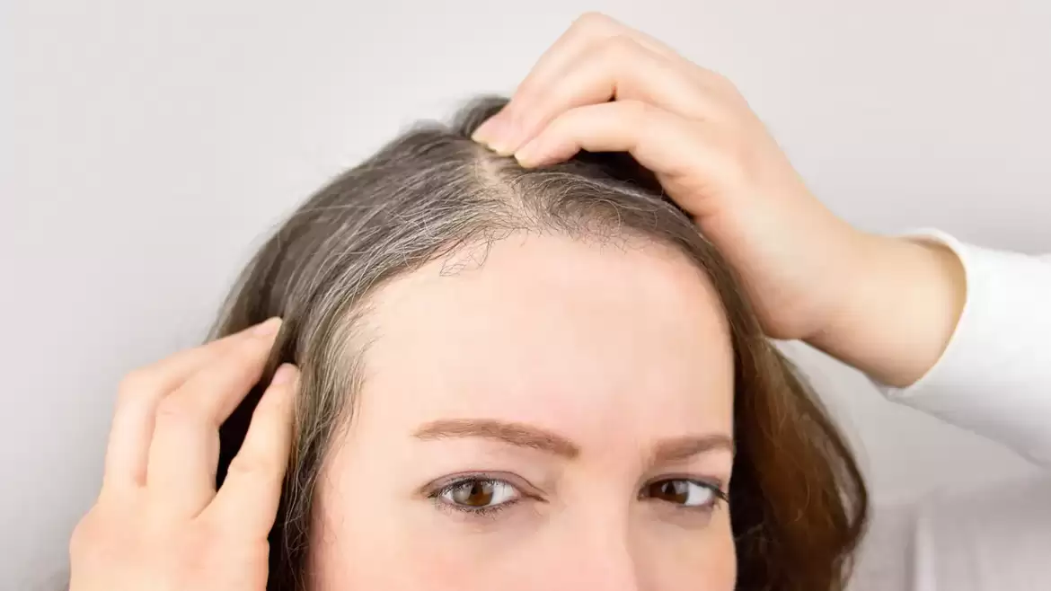 ¿POR QUÉ TE SALEN CANAS Y CÓMO PUEDES PREVENIRLAS?
